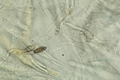 Cercophora lanuginosa