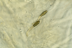 Cercophora lanuginosa