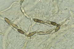 Cercophora lanuginosa