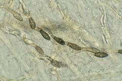 Cercophora lanuginosa