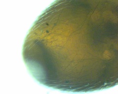 Pergamasus