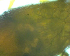 Pergamasus
