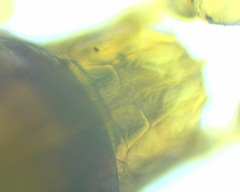 Pergamasus
