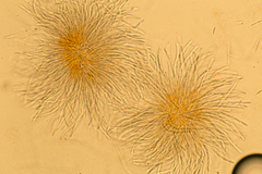 Hypomyces armeniacus