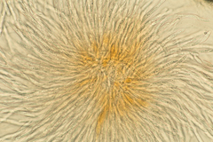 Hypomyces armeniacus