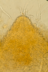 Hypomyces armeniacus