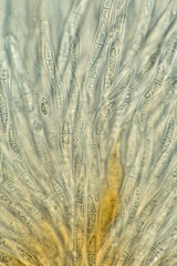 Hypomyces armeniacus