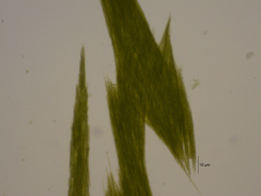 Aphanizomenon flosaquae