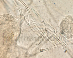 Hydnocristella himantia