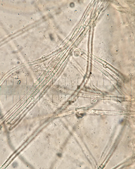 Hydnocristella himantia