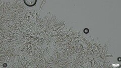 Hydnocristella himantia