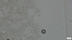 Hydnocristella himantia