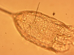 Keratella cochlearis