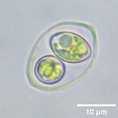 Oocystis