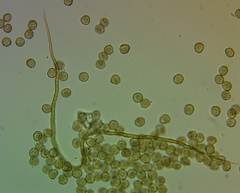 Trichia crateriformis
