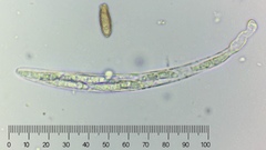 Echinosphaeria canescens