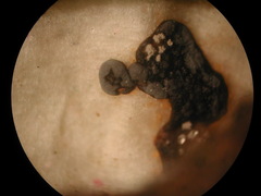 Diderma chondrioderma