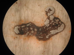 Diderma chondrioderma