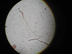 Diderma chondrioderma