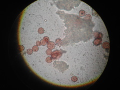 Diderma chondrioderma