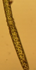 Pleurotaenium trabecula