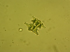 Staurastrum distentum