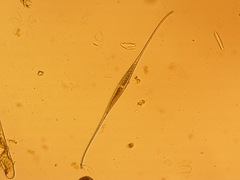 Closterium kuetzingii