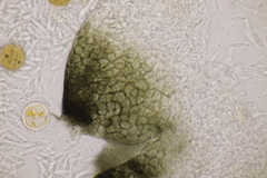 Sphaerellopsis filum