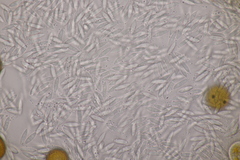 Sphaerellopsis filum