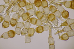 Puccinia cnici-oleracei