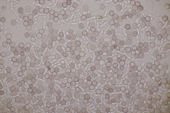 Microbotryum superbum