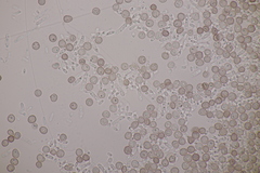 Microbotryum superbum