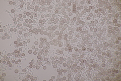 Microbotryum superbum