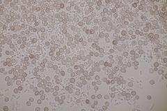 Microbotryum superbum