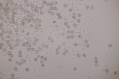 Microbotryum superbum