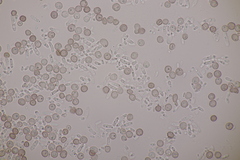 Microbotryum superbum