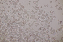 Microbotryum superbum