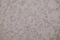 Microbotryum superbum