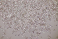 Microbotryum superbum