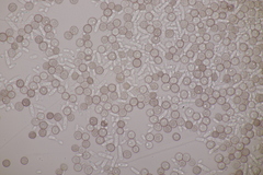 Microbotryum superbum