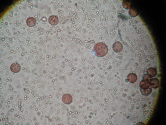 Physarum melleum