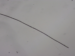 Dolichospermum planctonicum