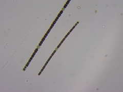 Dolichospermum planctonicum