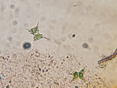 Staurodesmus extensus