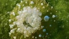 Bunodeopsis globulifera