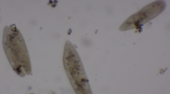 Paramecium