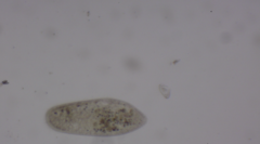 Paramecium