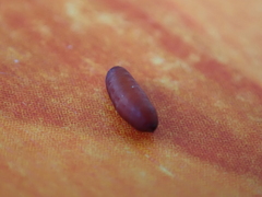Pegomya hyoscyami group