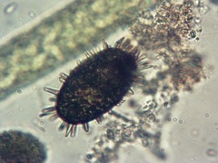 Trachelomonas hystrix