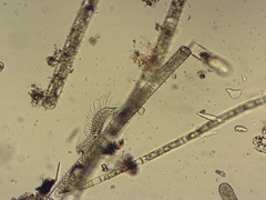 Gastrotricha